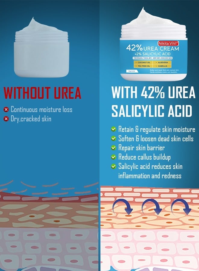 NIKITA.VIVI كريم يوريا 150 جرام 42% مع حمض الساليسيليك لعلاج تشققات القدمين واليدين وإزالة الكالو وكريم اليدين وكريم القدمين لتشققات كعب القدم والمرفقين والأظافر والركب ومرطب البشرة مع أقصى قوة - Image 4